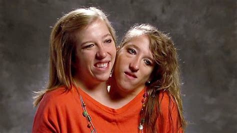 brittany and abby hensel porn|Conjoined Twins Abby and Brittany Hensel Posted Details About。